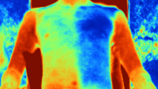 红外成像显示与普通棉（左）相比，新型织物（右）可以显著降低人体温度 　　图片来源：science.org